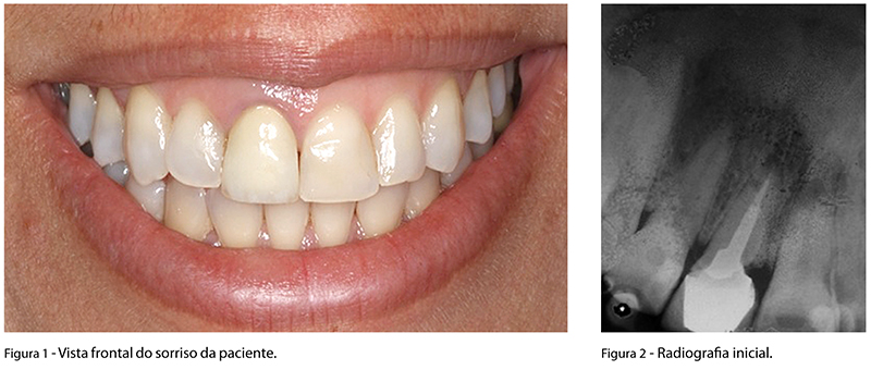Caso_Clinico_fig01,02