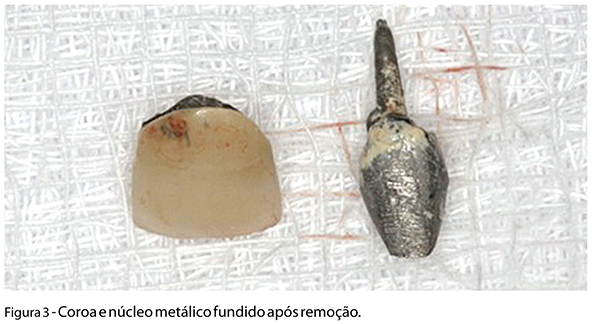 Caso_Clinico_fig03