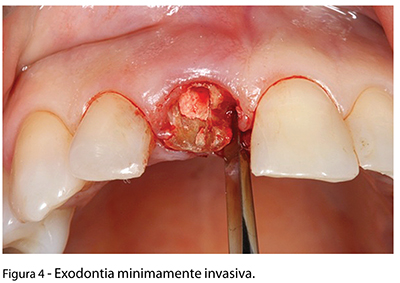 Caso_Clinico_fig04