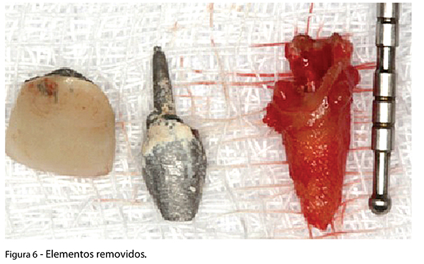 Caso_Clinico_fig06