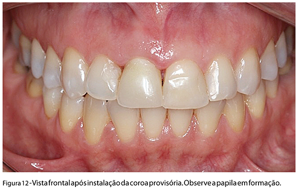 Caso_Clinico_fig12