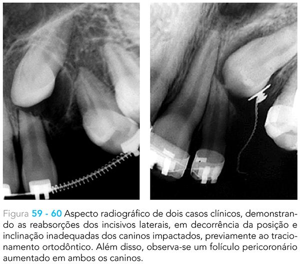 Ecxpert_V12n01_fig02