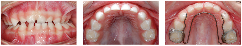 Ecxpert_V12n01_fig04