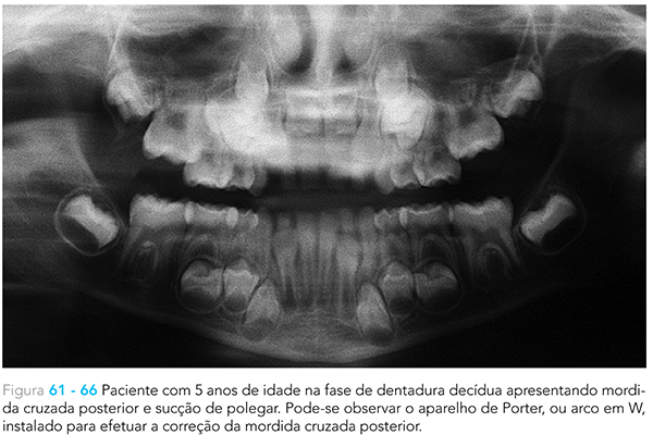 Ecxpert_V12n01_fig05