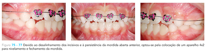 Ecxpert_V12n01_fig07