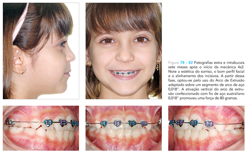 Ecxpert_V12n01_fig08