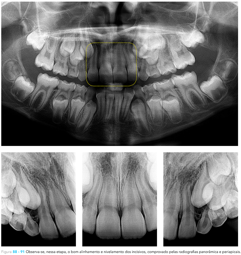 Ecxpert_V12n01_fig10