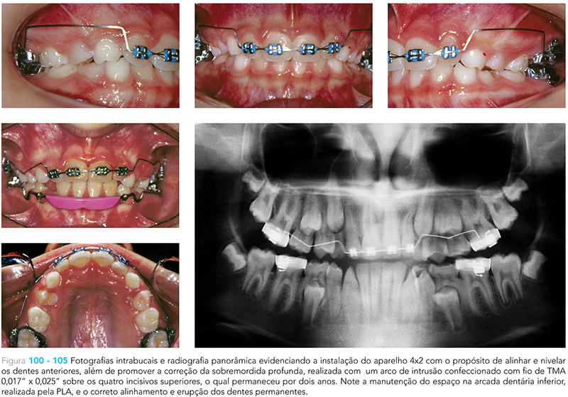 Ecxpert_V12n01_fig12