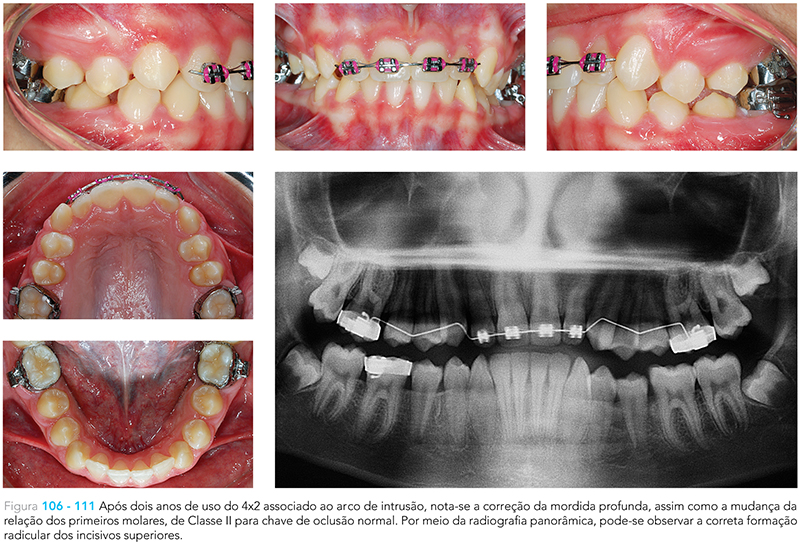Ecxpert_V12n01_fig13