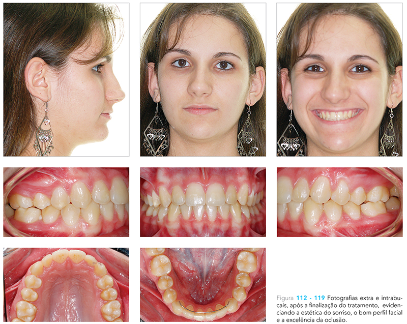 Ecxpert_V12n01_fig14