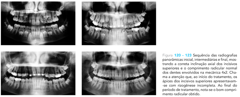 Ecxpert_V12n01_fig15