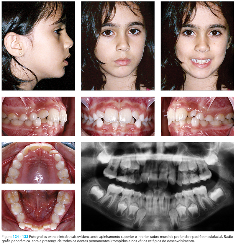 Ecxpert_V12n01_fig16