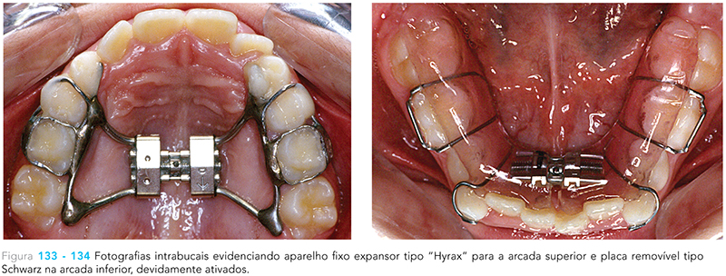 Ecxpert_V12n01_fig17