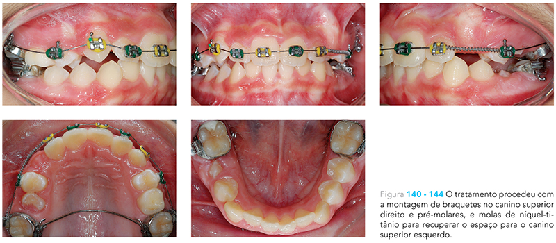 Ecxpert_V12n01_fig19