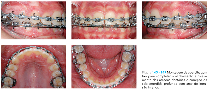 Ecxpert_V12n01_fig20