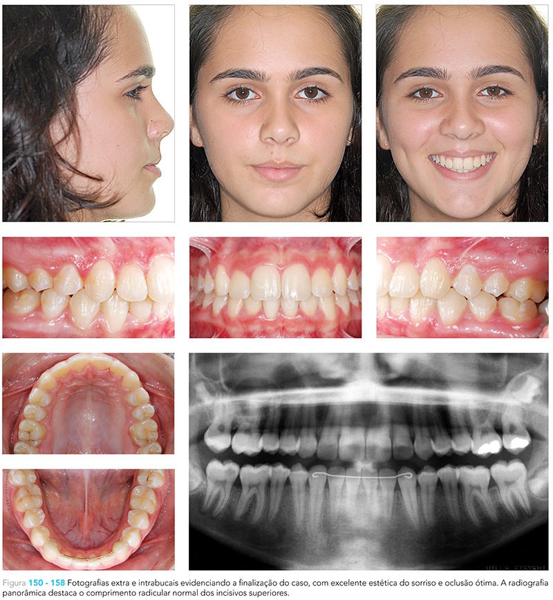Ecxpert_V12n01_fig21