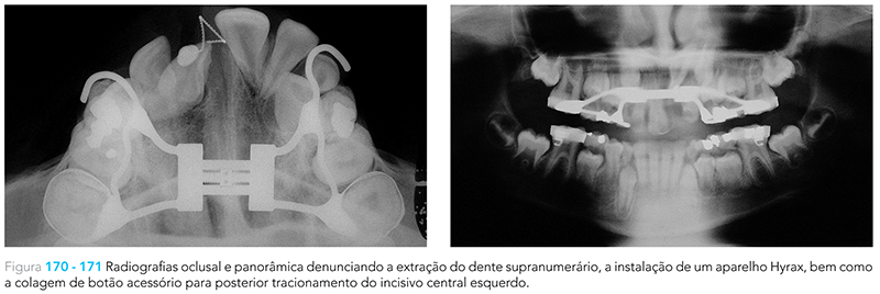 Ecxpert_V12n01_fig24