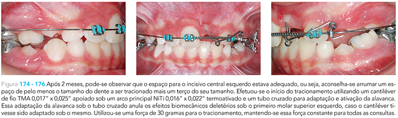 Ecxpert_V12n01_fig26