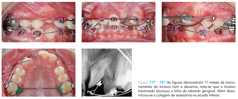 Ecxpert_V12n01_fig27