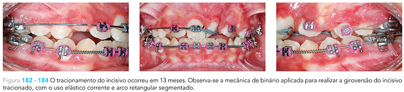 Ecxpert_V12n01_fig28