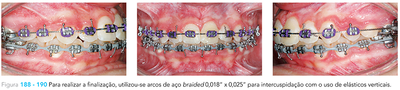 Ecxpert_V12n01_fig30