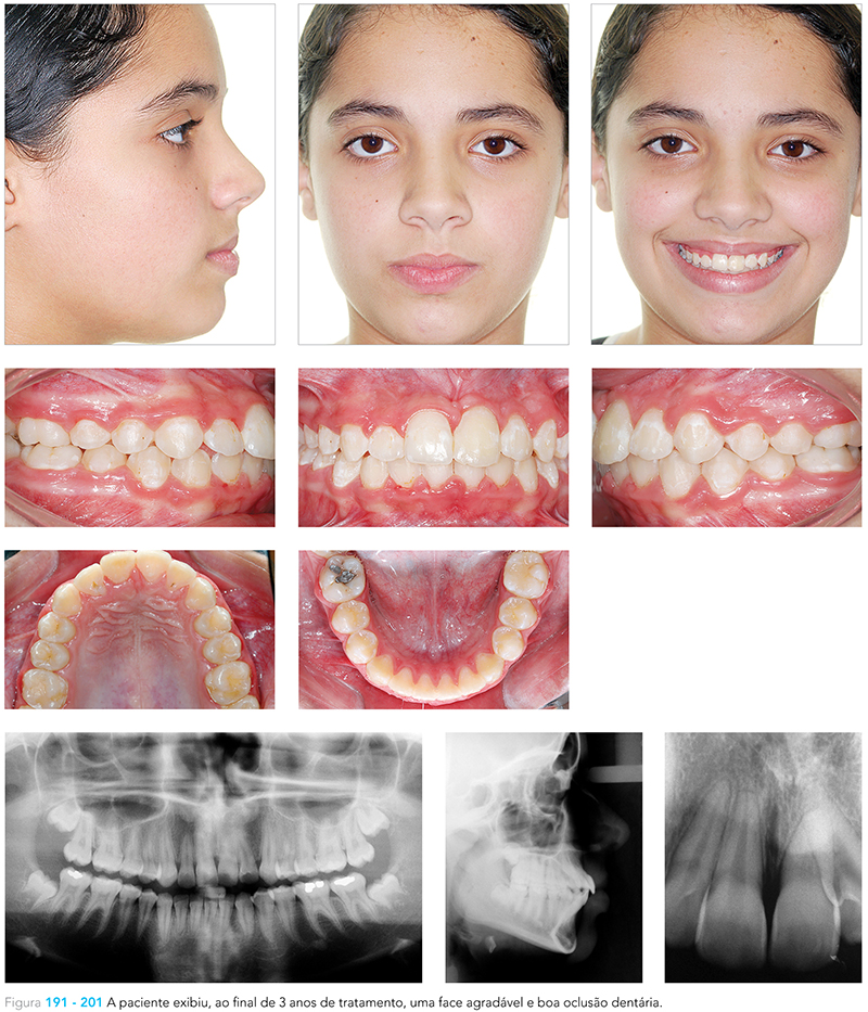 Ecxpert_V12n01_fig31