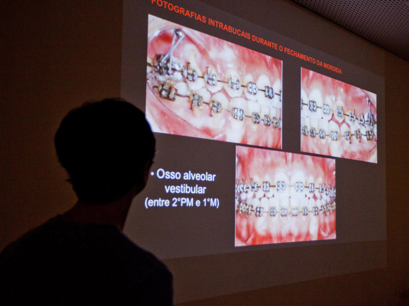 Seminário Monografia Dental Press O Portal de conteúdo de Odontologia