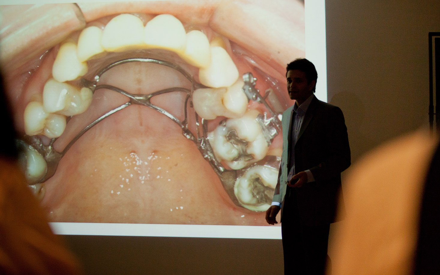 Dental Press 8º Curso de MiniImplante, com os Drs. Adilson Ramos e