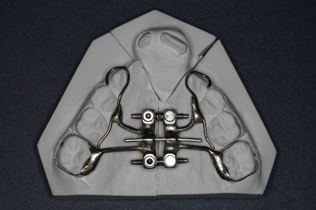 12043752_10203499428806172_1499356146_o Dental Press O Portal de