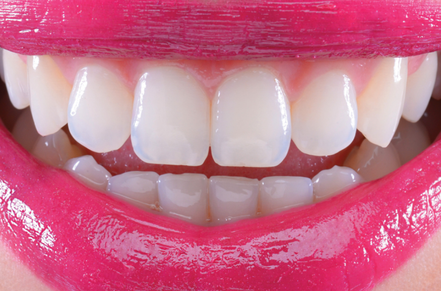 sorriso1