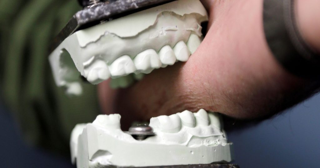 Dental Press Marca de mordida deve