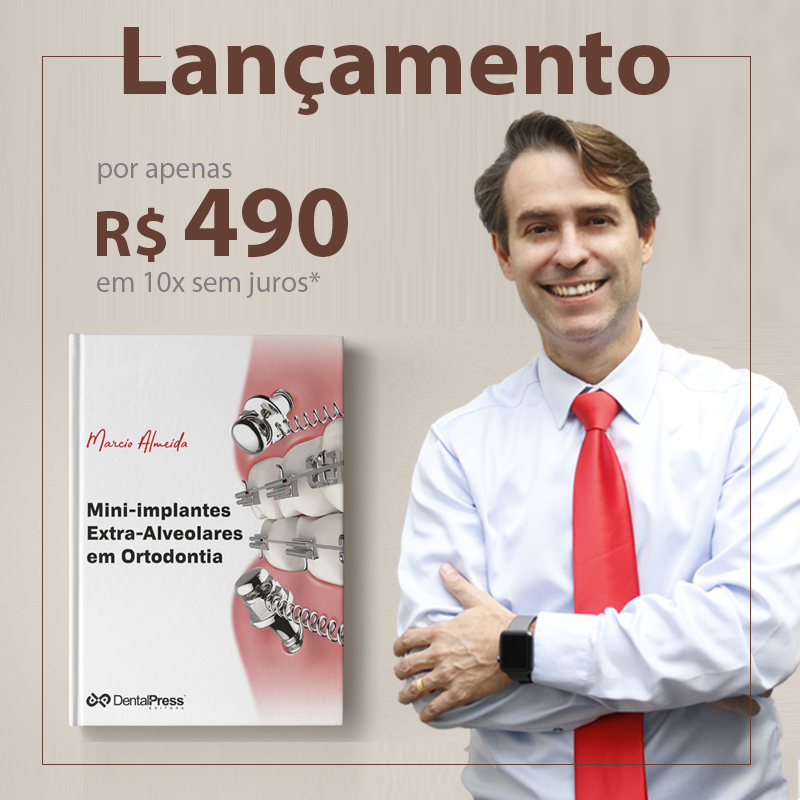 Dental Press Aparelho de Protração Mandibular com aparelho fixo