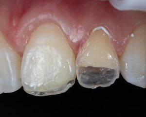 MG 6233