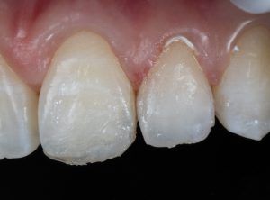 MG 6245
