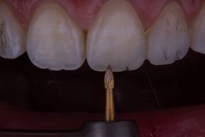 MG 6395