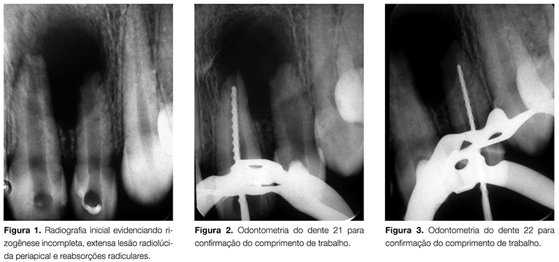 Artigos_ENDO_v02_n03_fig01-2-3