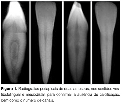 Artigos_ENDO_v02_n03_fig01