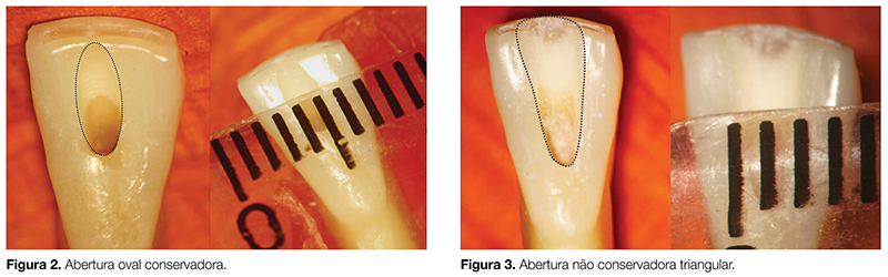 Artigos_ENDO_v02_n03_fig02-3