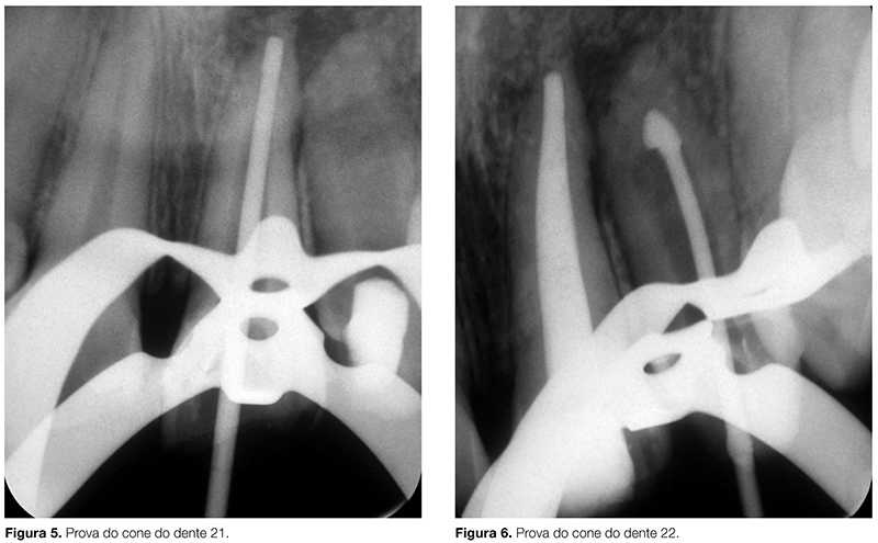 Artigos_ENDO_v02_n03_fig05-6
