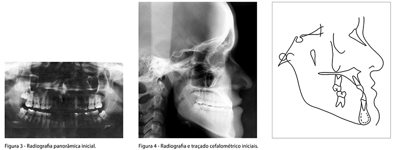 BBO_v18_n01_fig03_04