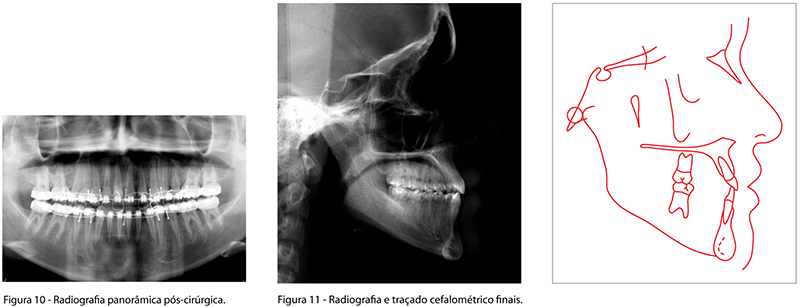 BBO_v18_n01_fig10_11