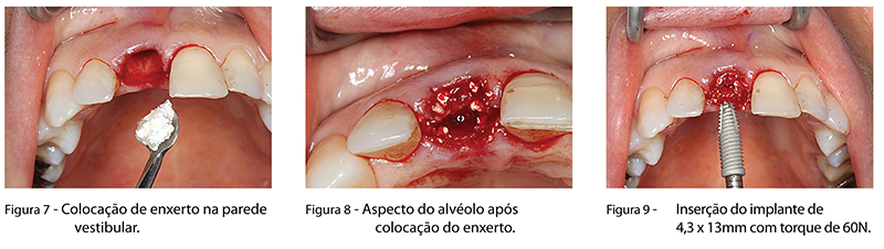 Caso_Clinico_fig07,08,09