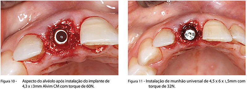 Caso_Clinico_fig10,11
