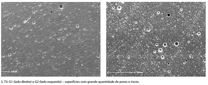 Casos_Estetica_v10_n01_fig11