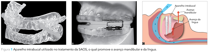 Expert_v12_n02_fig01