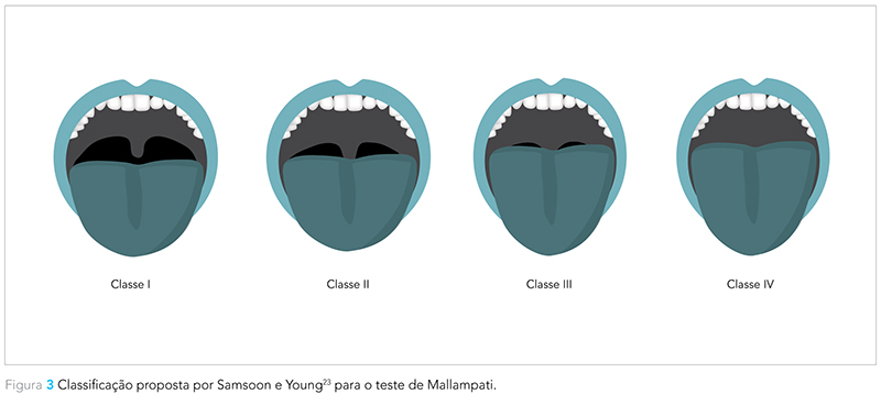 Expert_v12_n02_fig03