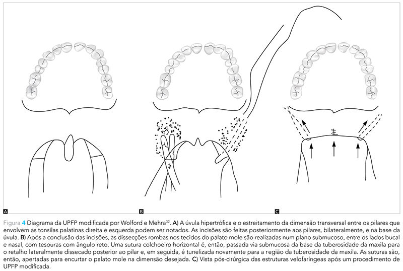 Expert_v12_n02_fig04