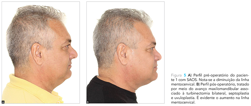 Expert_v12_n02_fig05