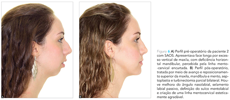 Expert_v12_n02_fig06