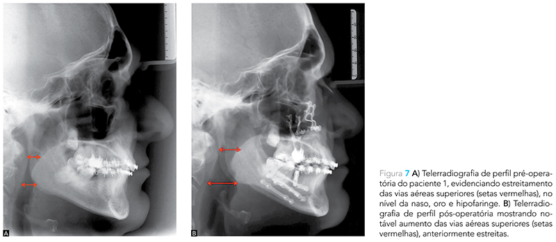 Expert_v12_n02_fig07